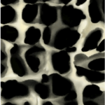 Osteoporosis Microstructure